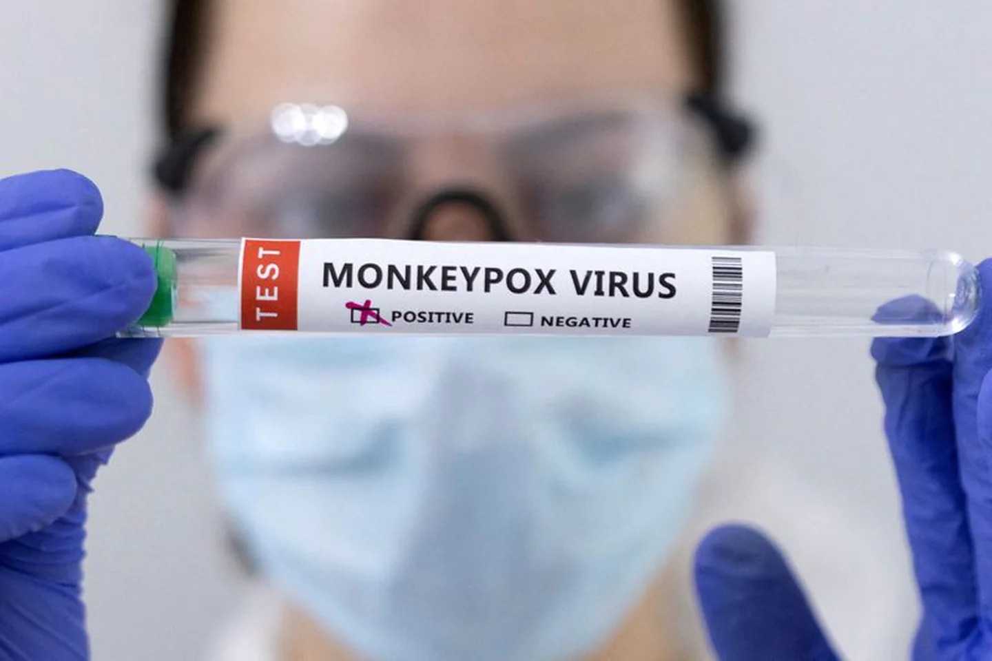 Protocolo de Vigilancia de Viruela Símica