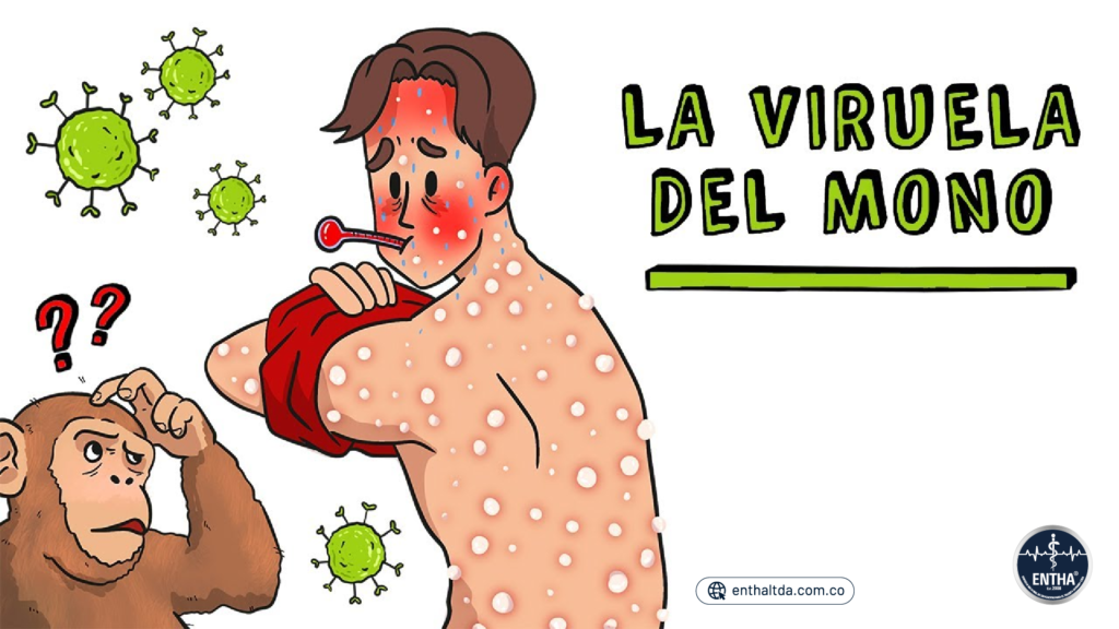 Viruela Símica: ¿Cómo la enfrentamos en Colombia?