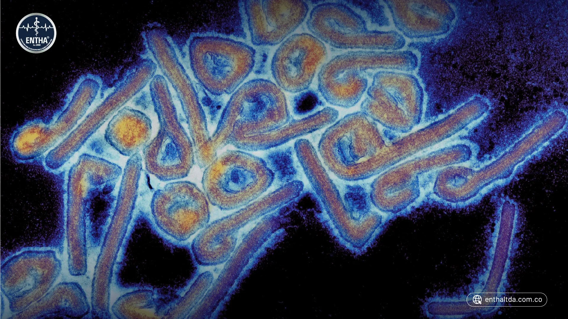 Virus de Marburgo: ¿Qué tan mortal es?