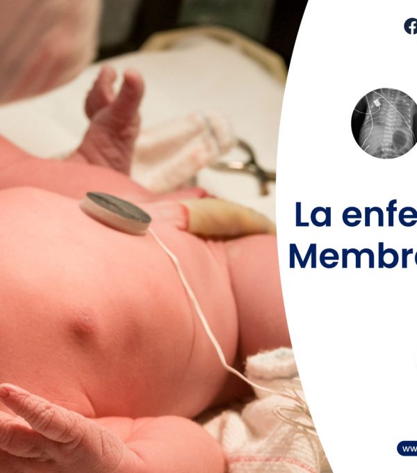 La Enfermedad de la Membrana Hialina