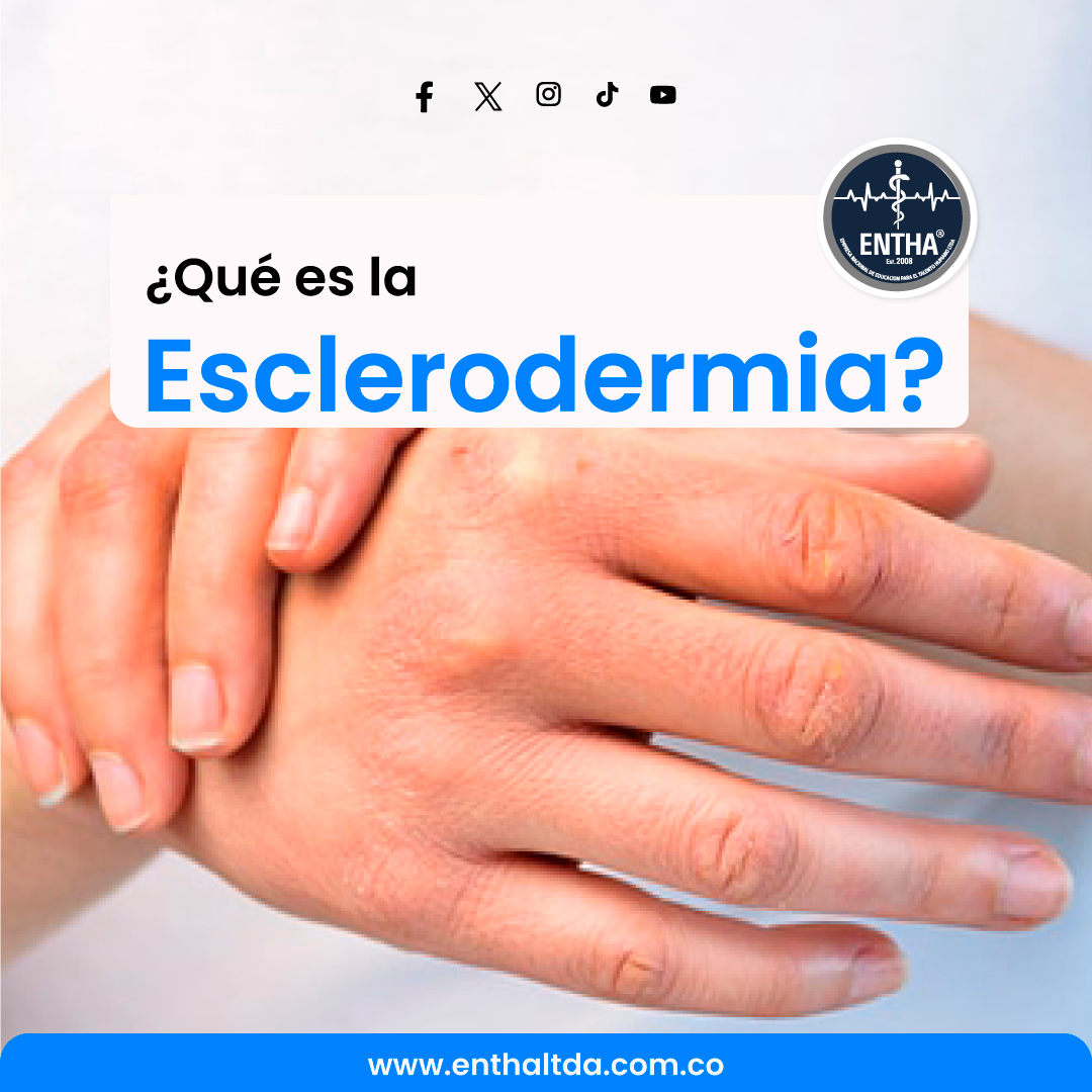 ¿Qué es la Esclerodermia?