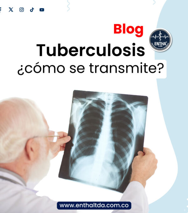 Tuberculosis: ¿cómo se transmite?