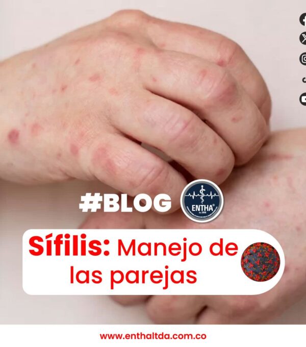 Sífilis: Manejo de las Parejas