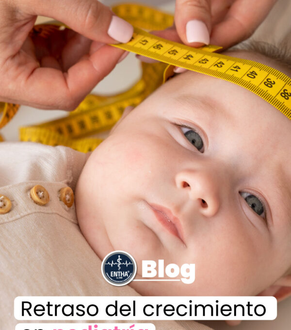 RETRASO DEL CRECIMIENTO EN PEDIATRÍA