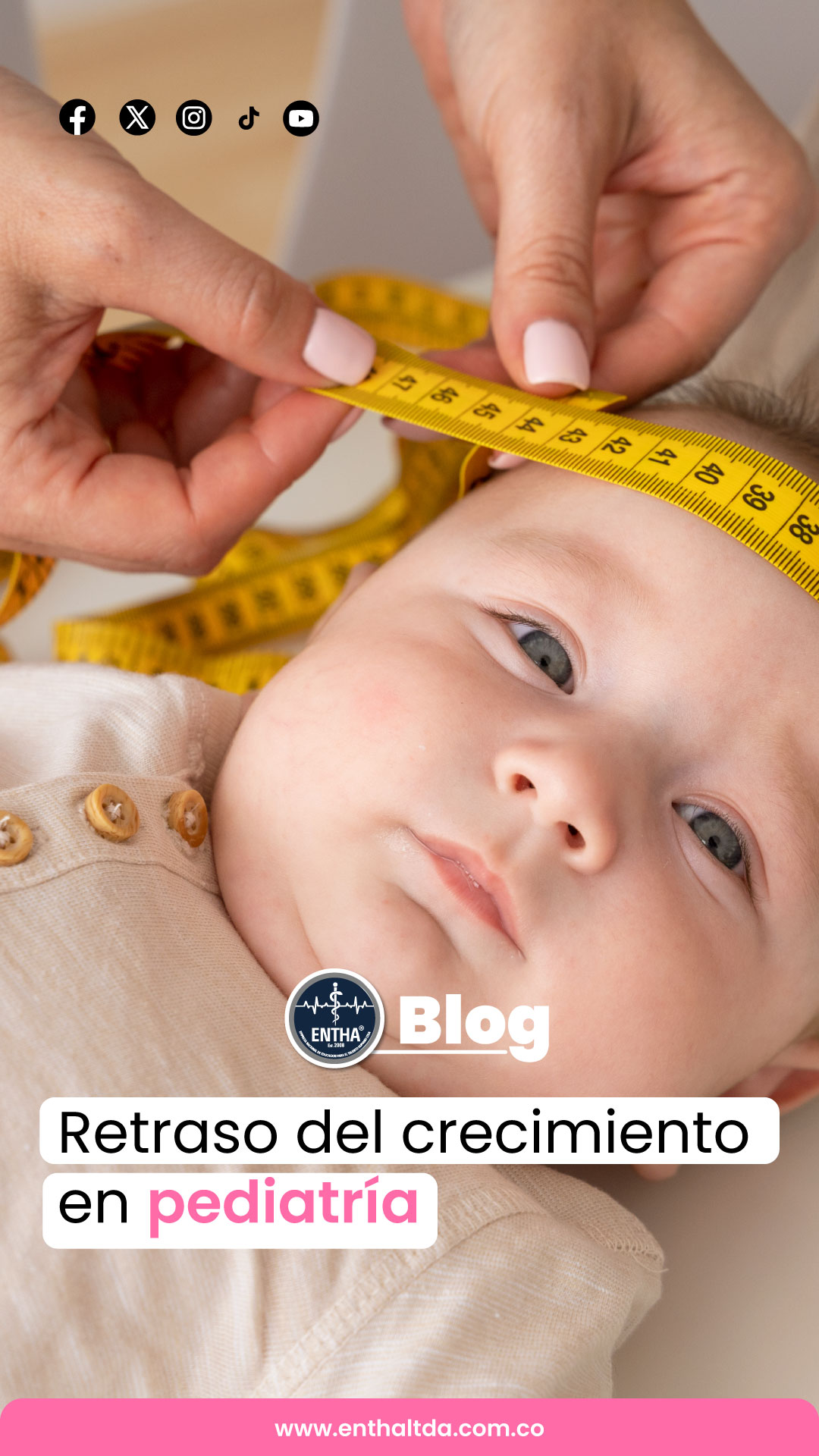 RETRASO DEL CRECIMIENTO EN PEDIATRÍA