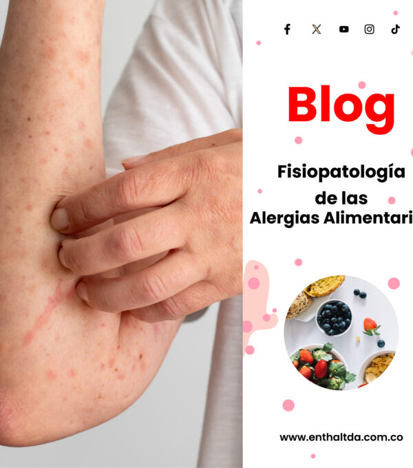 Fisiopatología de las Alergias Alimentarias