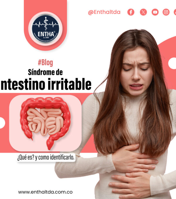 Síndrome de intestino irritable: ¿qué es? y como identificarlo