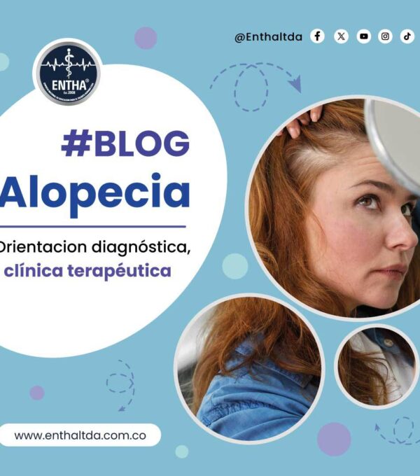 Alopecia: orientación diagnóstica, clínica y terapéutica