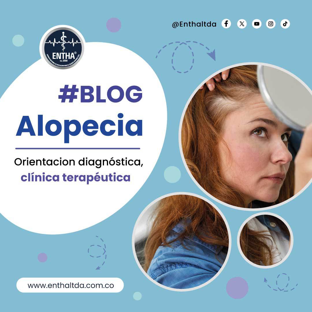 Alopecia: orientación diagnóstica, clínica y terapéutica