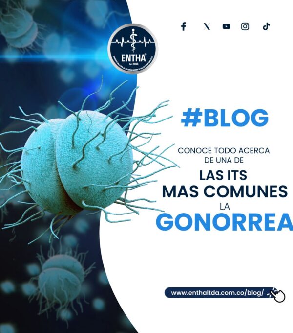 Conoce todo acerca de una de las ITS mas comunes, La Gonorrea
