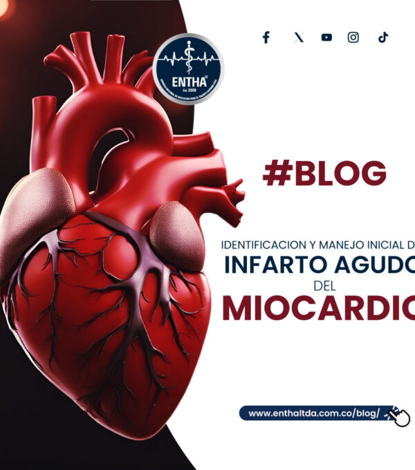 Identificación y manejo inicial del infarto agudo del miocardio