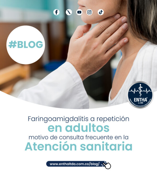 Faringoamigdalitis a repetición en adultos, motivo de consulta frecuente en la atención sanitaria