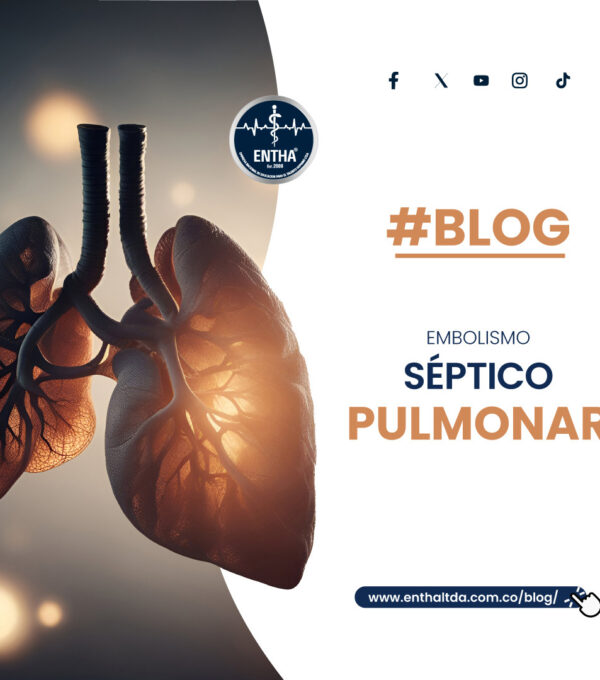 Embolismo Séptico Pulmonar, ¿Patología rara o bastante común?