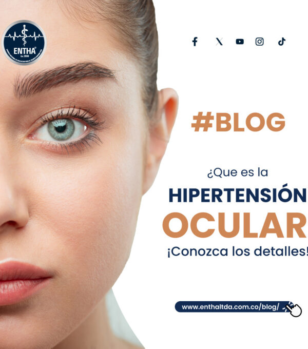 Que es la hipertensión ocular, conozca los detalles