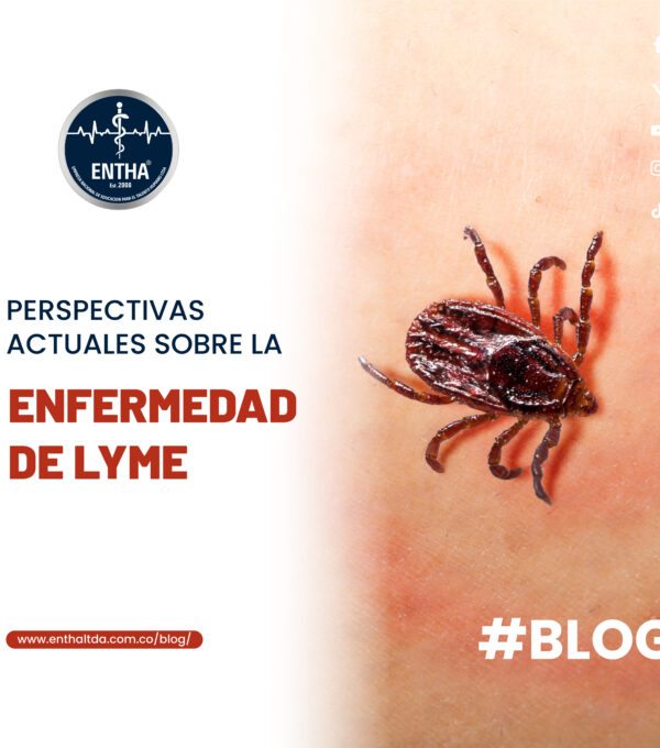 Perspectivas Actuales sobre la Enfermedad de Lyme