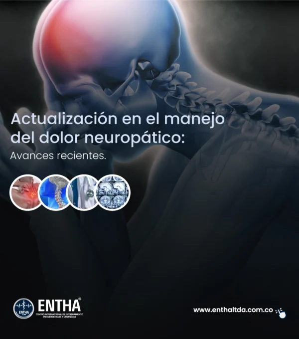 Actualización en el manejo del dolor neuropático: opciones terapéuticas