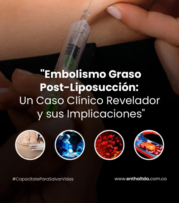 Embolismo Graso Post-Liposucción: Un Caso Clínico Revelador y sus Implicaciones
