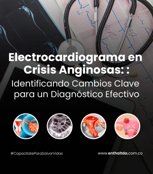 Electrocardiograma en Crisis Anginosas: Identificando Cambios Clave para un Diagnóstico Efectivo
