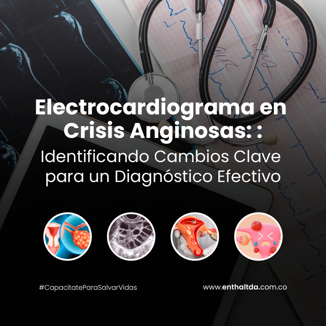 Electrocardiograma en Crisis Anginosas: Identificando Cambios Clave para un Diagnóstico Efectivo