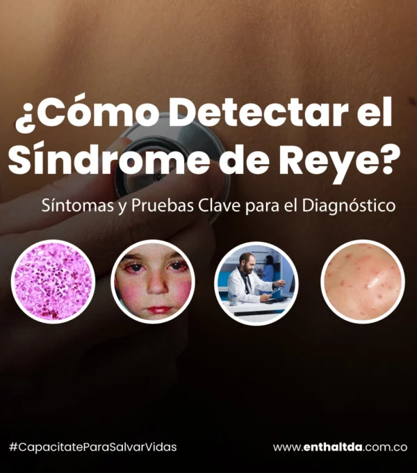 ¿Cómo Detectar el Síndrome de Reye? Síntomas y Pruebas Clave para el Diagnóstico