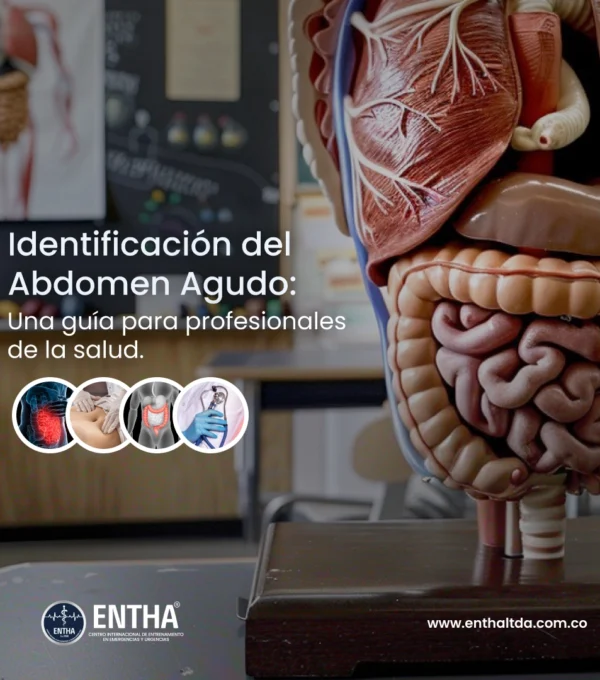 Identificación del Abdomen Agudo: Una Guía para Profesionales de la Salud