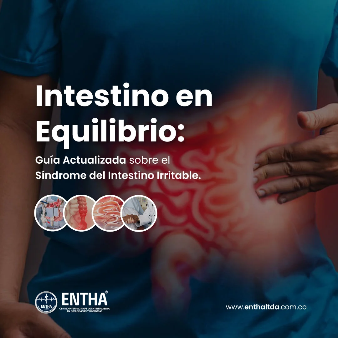 Intestino en Equilibrio: Guía Actualizada sobre el Síndrome del Intestino Irritable