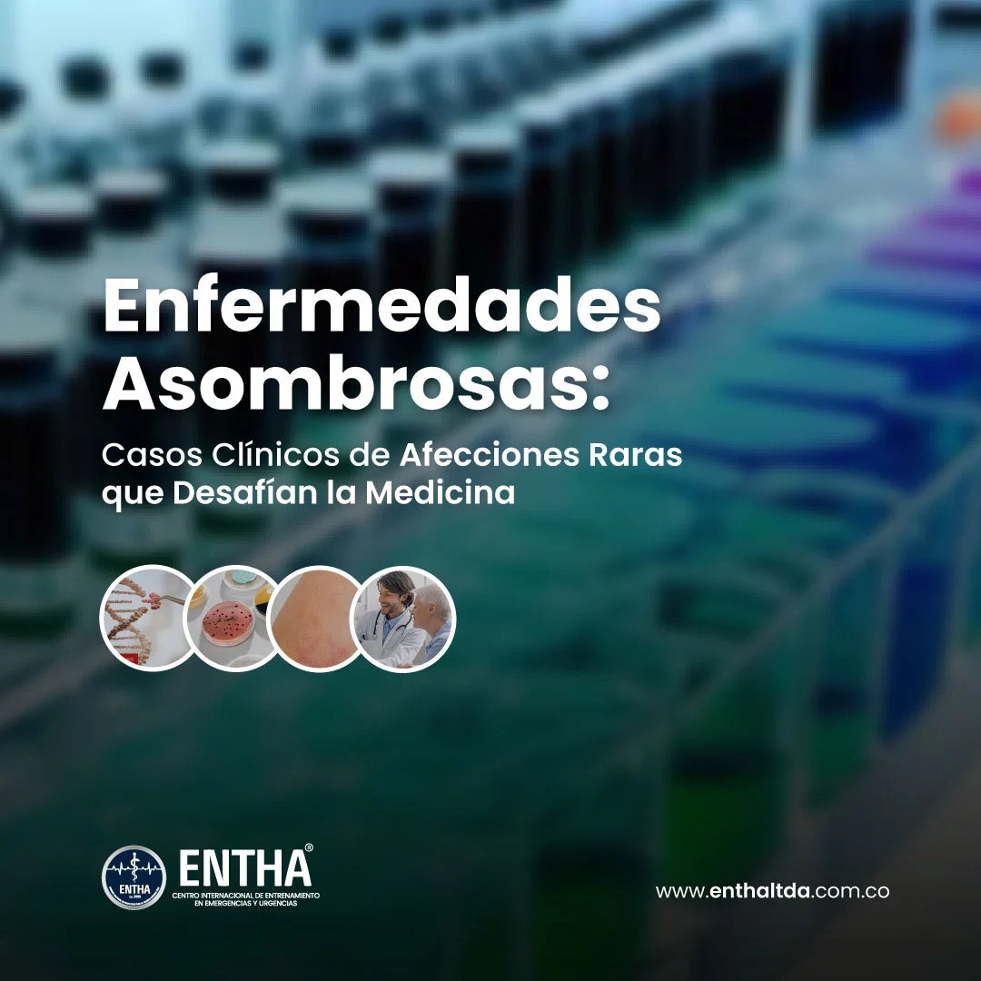 Enfermedades Asombrosas: Casos Clínicos de Afecciones Raras que Desafían la Medicina