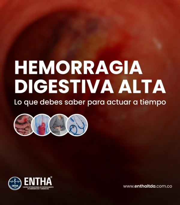 Hemorragia Digestiva Alta: Lo Que Debes Saber Para Actuar a Tiempo