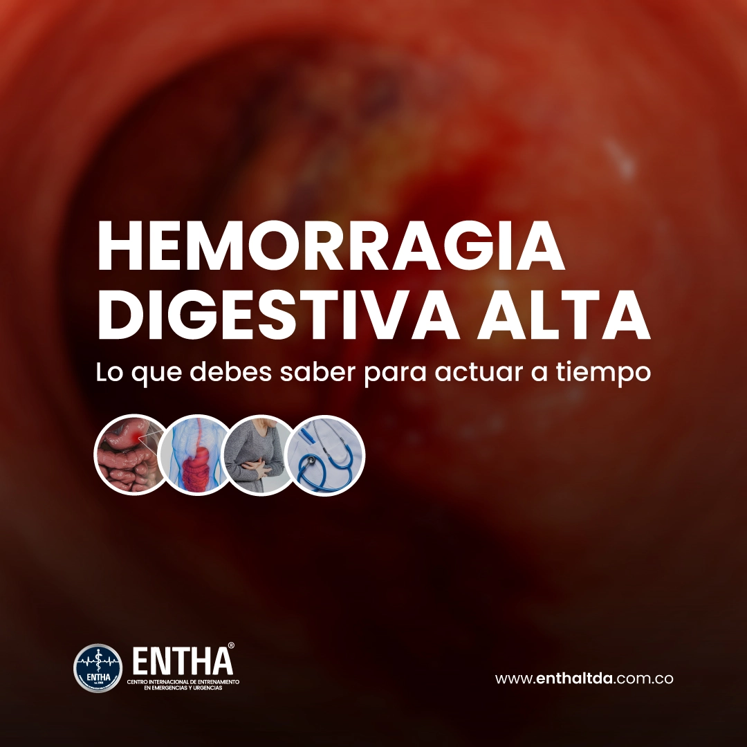 Hemorragia Digestiva Alta: Lo Que Debes Saber Para Actuar a Tiempo
