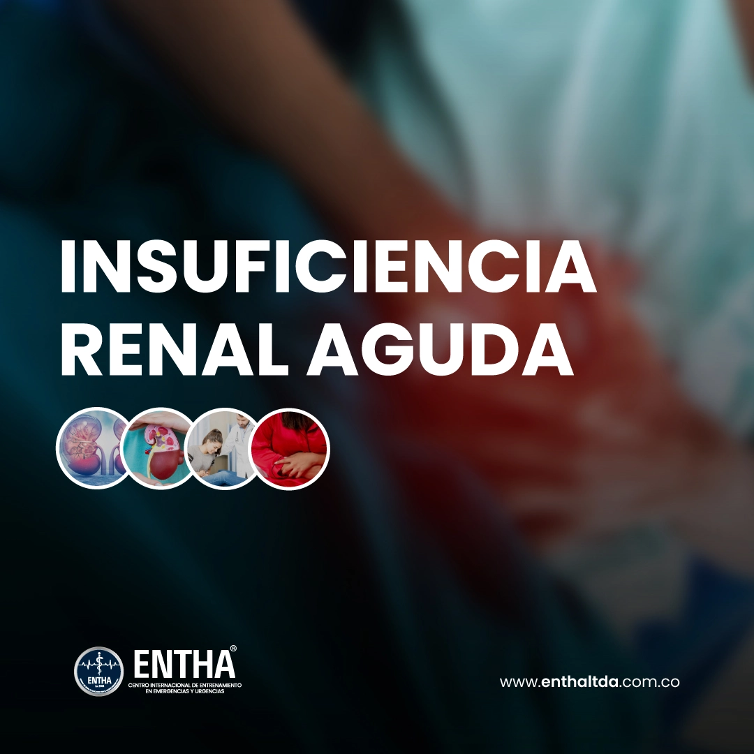 Insuficiencia Renal Aguda
