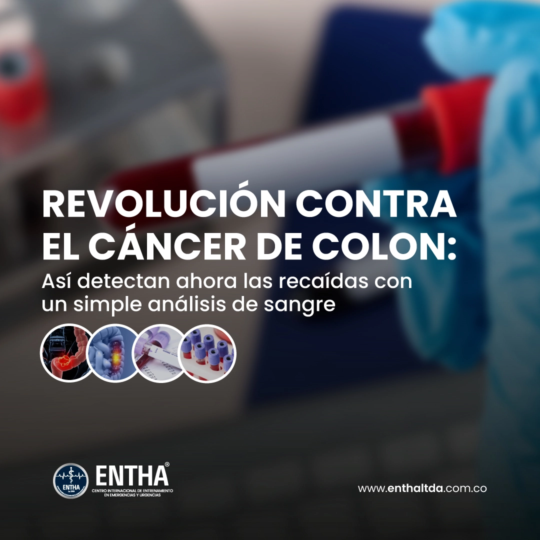 Revolución contra el cáncer de colon: así detectan ahora las recaídas con un simple análisis de sangre